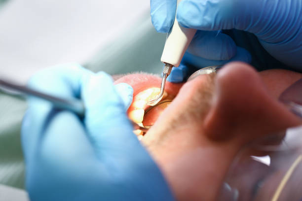 Best Emergency Treatment for Toothache in Medina, OH